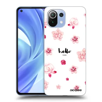 Obal pro Xiaomi Mi 11 - Hello there