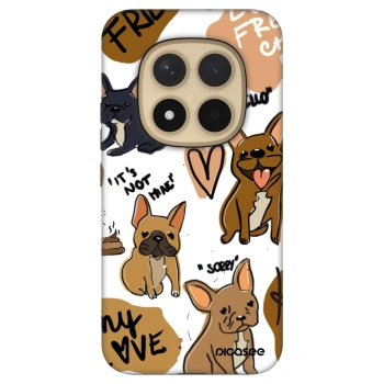 Picasee Fashion Case pro Xiaomi Redmi Note 15 Pro+ - Frenchies