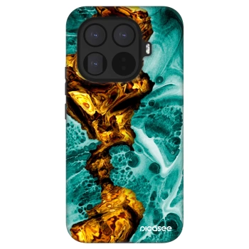 Picasee Fashion Case pro Xiaomi 15T Pro - Goldsky