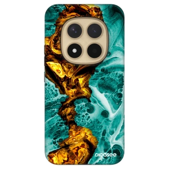 Picasee Fashion Case pro Xiaomi Redmi Note 15 Pro+ - Goldsky