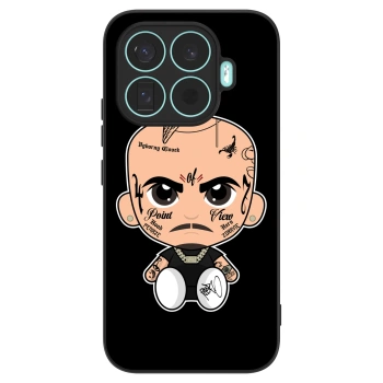 Obal pro Xiaomi 17T - Separ