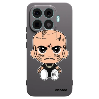 Obal pro Xiaomi 17T Pro - Separ