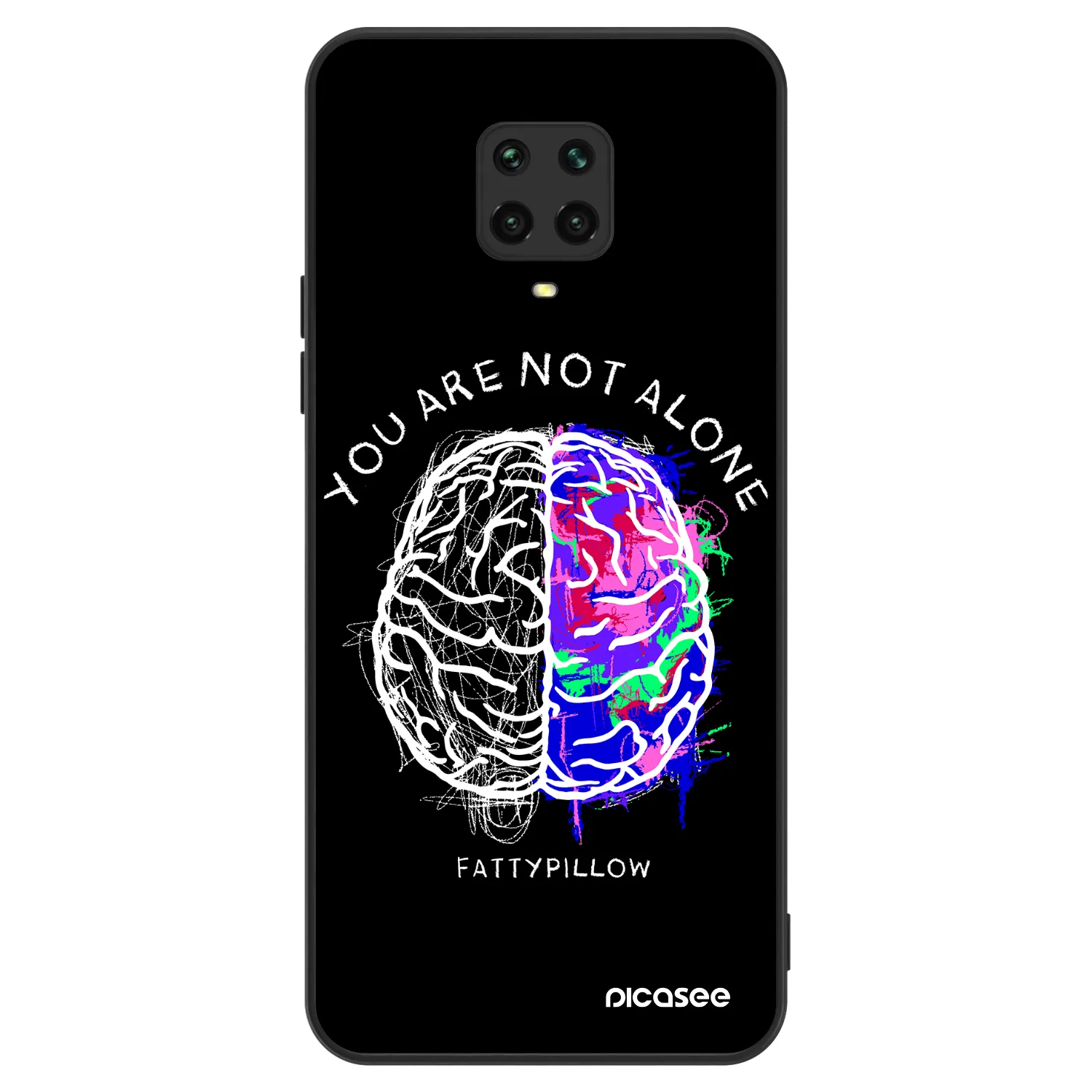 Picasee ULTIMATE CASE pro Xiaomi Redmi Note 9S - Brain - White