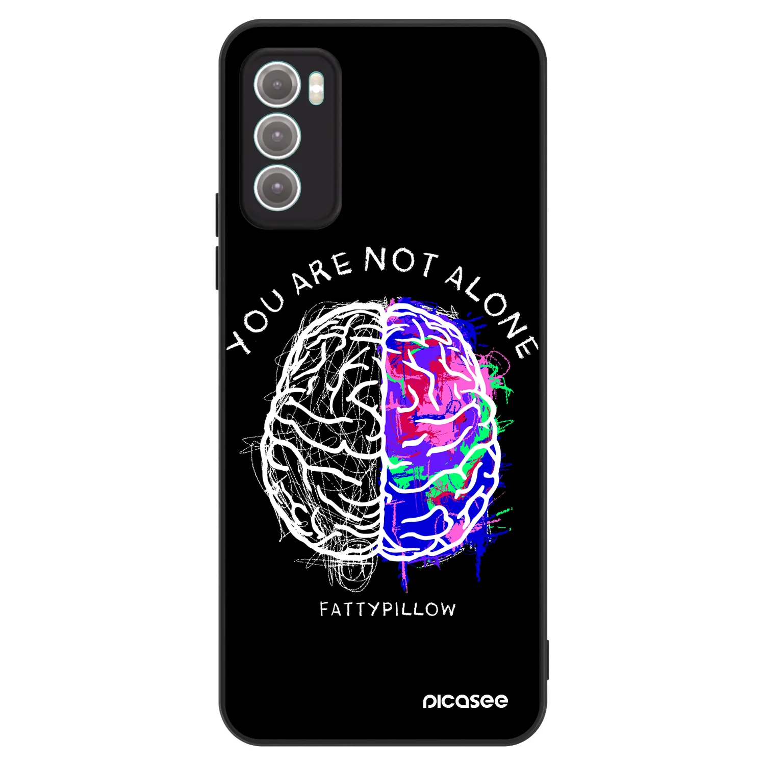 Picasee ULTIMATE CASE pro Motorola Moto G60 - Brain - White