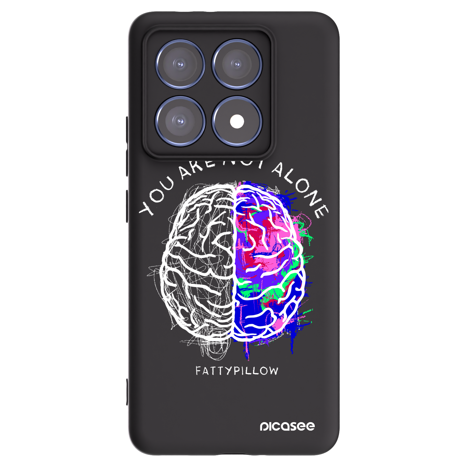 Picasee silikonový černý obal pro Xiaomi 14T Pro - Brain - White