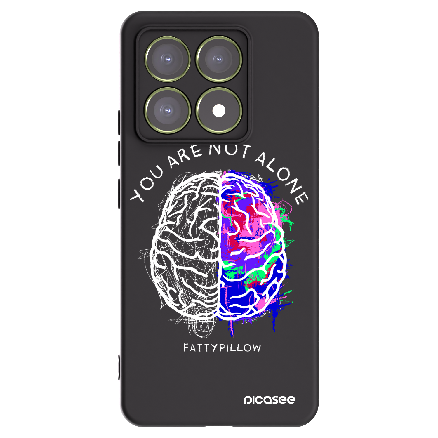 Picasee silikonový černý obal pro Xiaomi 14T - Brain - White