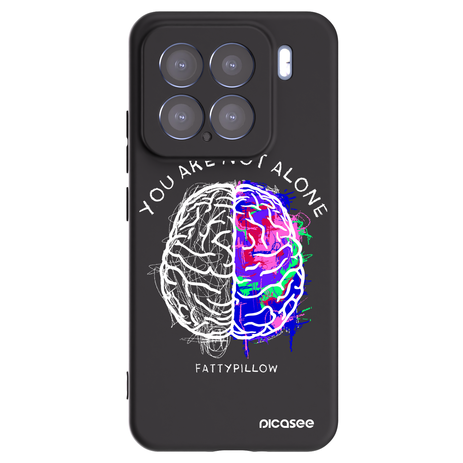 Picasee silikonový černý obal pro Xiaomi 15 - Brain - White