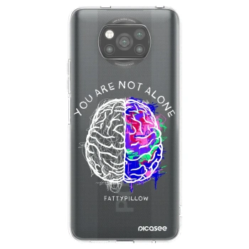 Picasee silikonový černý obal pro Xiaomi Poco X3 Pro - Brain - White
