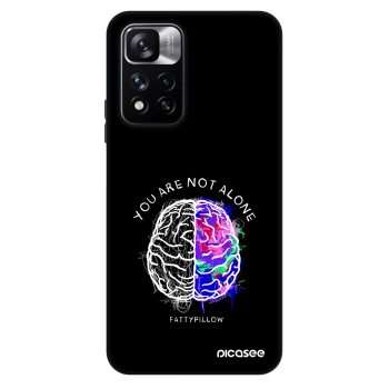 Obal pro Xiaomi Redmi Note 11 Pro 5G - Brain - White