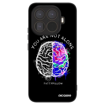 Obal pro Xiaomi 15T Pro - Brain - White