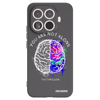 Picasee silikonový černý obal pro Xiaomi 15T Pro - Brain - White