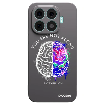 Obal pro Xiaomi 17T Pro - Brain - White