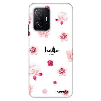 Obal pro Xiaomi 11T Pro - Hello there