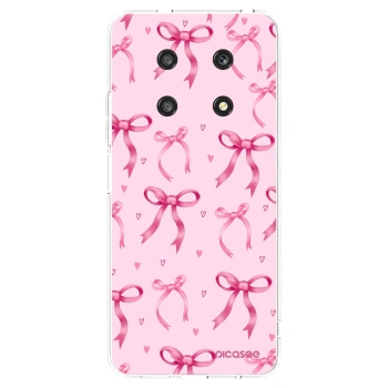 Picasee silikonový průhledný obal pro Honor Magic4 Lite 5G - Bow Aesthetic