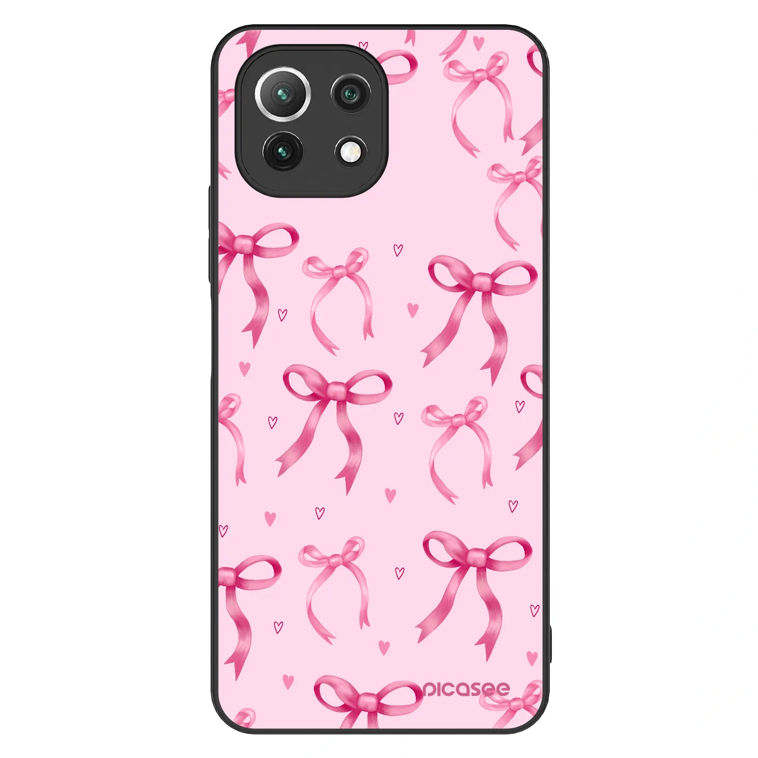 Picasee ULTIMATE CASE pro Xiaomi 11 Lite 5G NE - Bow Aesthetic