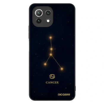 Obal pro Xiaomi 11 Lite 5G NE - CANCER